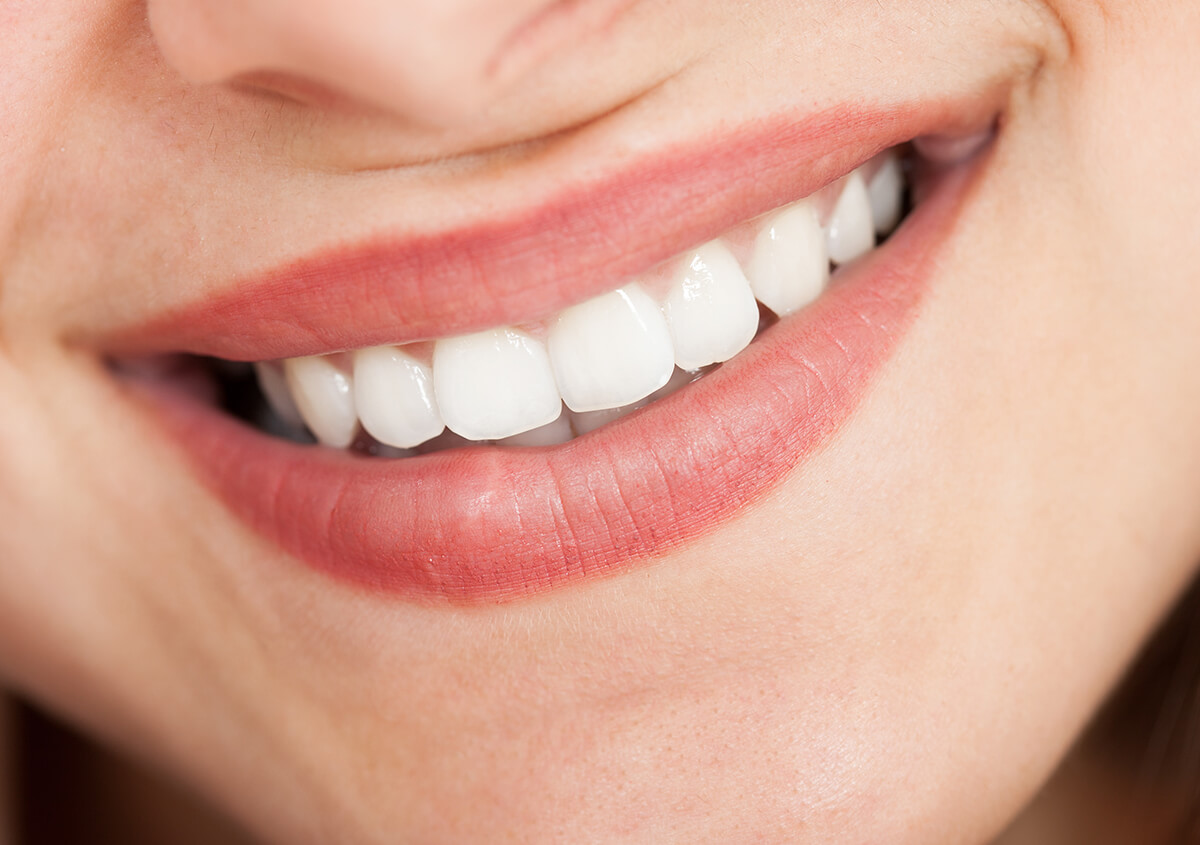 Teeth Whitening Dentist Draper in Utah Area